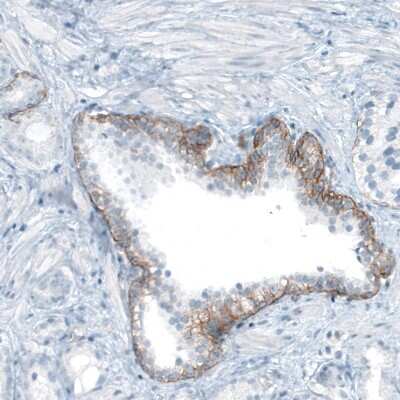 Immunohistochemistry-Paraffin: Integrin beta 4/CD104 Antibody (CL6973) [NBP2-76525]