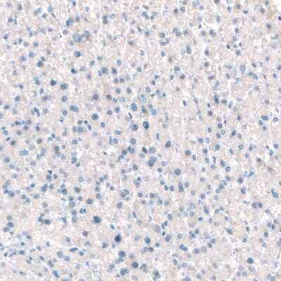 Immunohistochemistry-Paraffin: Integrin beta 4/CD104 Antibody (CL6973) [NBP2-76525]
