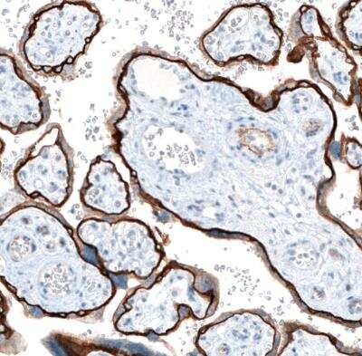 Immunohistochemistry-Paraffin: Integrin beta 4/CD104 Antibody (CL6973) [NBP2-76525]