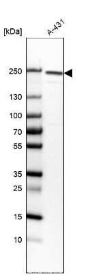 Western Blot: Integrin beta 4/CD104 Antibody (CL6973) [NBP2-76525]