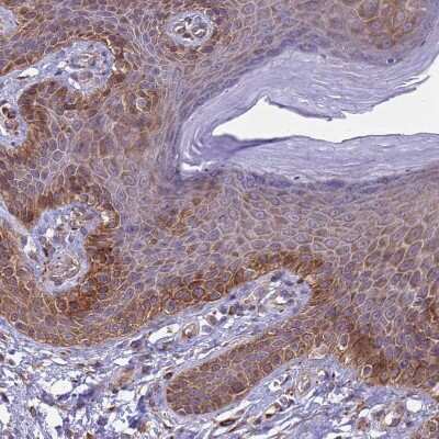 Immunohistochemistry-Paraffin: Integrin beta 4/CD104 Antibody [NBP2-38297]