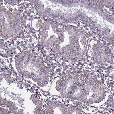 Immunohistochemistry-Paraffin: Integrin beta 4/CD104 Antibody [NBP2-38297]