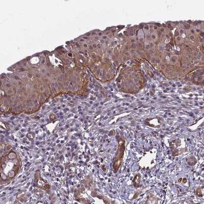 Immunohistochemistry-Paraffin: Integrin beta 4/CD104 Antibody [NBP2-38297]