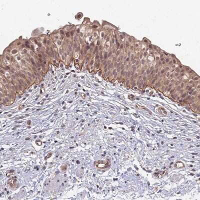 Immunohistochemistry-Paraffin: Integrin beta 4/CD104 Antibody [NBP2-38298]