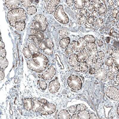 Immunohistochemistry-Paraffin: Integrin beta 4/CD104 Antibody [NBP2-38298]