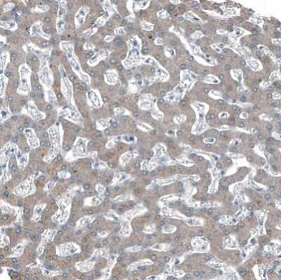 Immunohistochemistry-Paraffin: Integrin beta 4/CD104 Antibody [NBP2-38298]