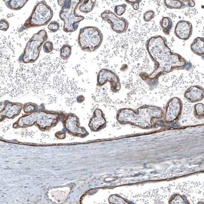 Immunohistochemistry-Paraffin: Integrin beta 4/CD104 Antibody [NBP2-38298]