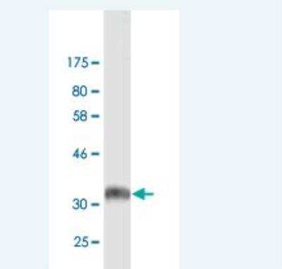 Western Blot: Integrin beta 5 Antibody (1D8) [H00003693-M02]