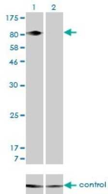 Western Blot: Integrin beta 5 Antibody (2C4) [H00003693-M01]