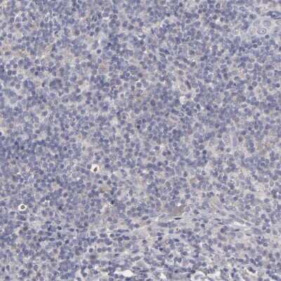 Immunohistochemistry-Paraffin: Integrin beta 5 Antibody [NBP1-88117]