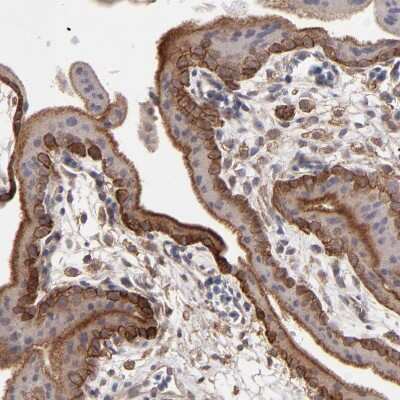 Immunohistochemistry-Paraffin: Integrin beta 5 Antibody [NBP1-88117]