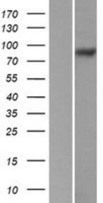 Western Blot: Integrin beta 5 Overexpression Lysate [NBP2-10813]