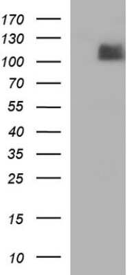 Western Blot: Integrin beta 6 Antibody (OTI1D2) [NBP2-45462]