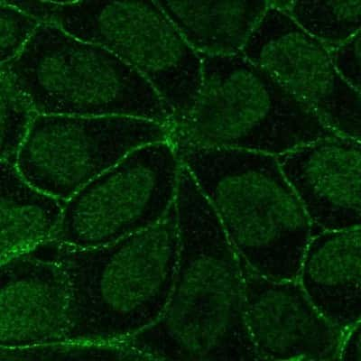 Immunocytochemistry/ Immunofluorescence: Integrin beta 6 Antibody [NBP2-14136]