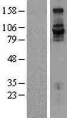 Western Blot: Integrin beta 7 Overexpression Lysate [NBL1-12076]