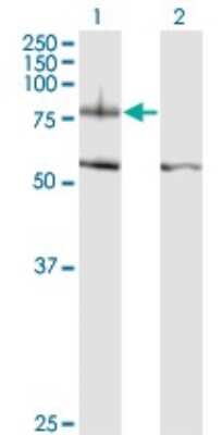 Western Blot: Integrin beta 8 Antibody (2B4) [H00003696-M01]