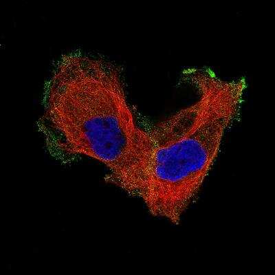 Immunocytochemistry/ Immunofluorescence: Integrin beta 8 Antibody (CL7290) [NBP2-76480]