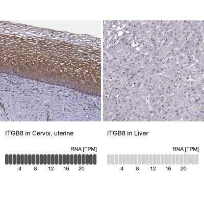 Immunohistochemistry-Paraffin: Integrin beta 8 Antibody [NBP1-87539]