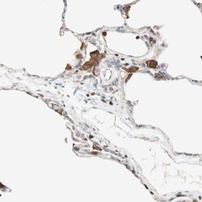 Immunohistochemistry-Paraffin: Integrin beta-like protein 1 Antibody [NBP1-82473]
