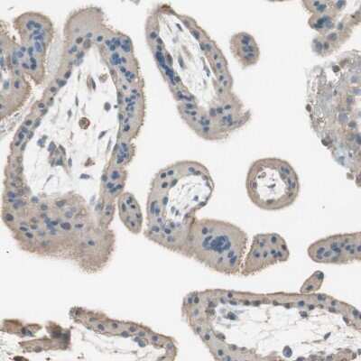Immunohistochemistry-Paraffin: Integrin beta-like protein 1 Antibody [NBP1-82473]