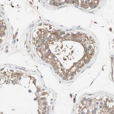 Immunohistochemistry-Paraffin: Integrin beta-like protein 1 Antibody [NBP1-82473]