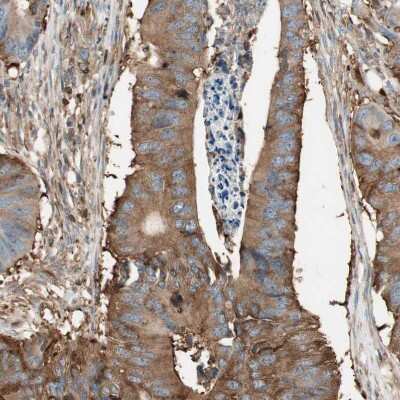 Immunohistochemistry-Paraffin: Integrin beta-like protein 1 Antibody [NBP1-82473]