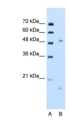 Western Blot: Integrin beta-like protein 1 Antibody [NBP1-59168]