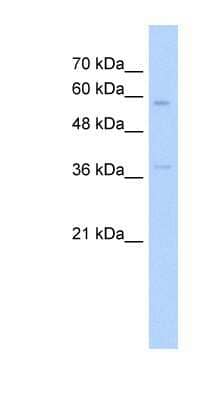 Western Blot: Integrin beta-like protein 1 Antibody [NBP1-59169]