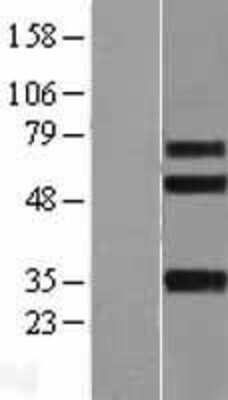 Western Blot: Integrin beta-like protein 1 Overexpression Lysate [NBL1-12077]