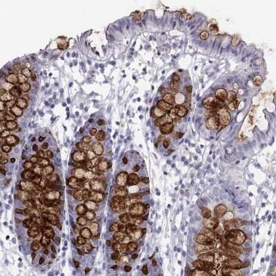 Immunohistochemistry-Paraffin: Intelectin-1/Omentin Antibody [NBP2-68855]