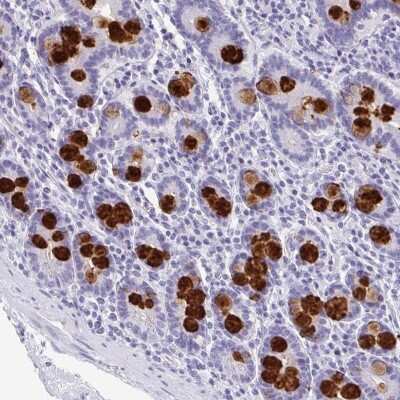 Immunohistochemistry: Intelectin-1/Omentin Antibody [NBP2-38989]
