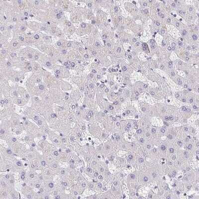 Immunohistochemistry-Paraffin: Intelectin-1/Omentin Antibody [NBP2-38989]