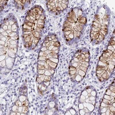 Immunohistochemistry-Paraffin: Intelectin-1/Omentin Antibody [NBP2-38989]