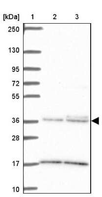 Western Blot: Intelectin-1/Omentin Antibody [NBP2-38989]