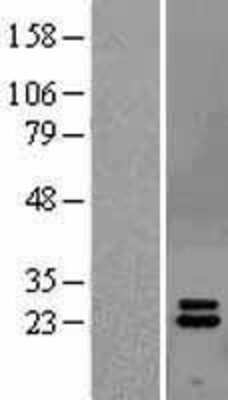 Western Blot: IFN-alpha 2 Overexpression Lysate [NBL1-11842]