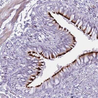 Immunohistochemistry: IFN-alpha K Antibody [NBP2-48878]