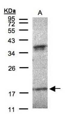 Western Blot: IFN-alpha K Antibody [NBP1-31156]