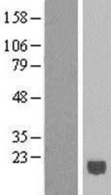 Western Blot: IFN-alpha K Overexpression Lysate [NBL1-11845]