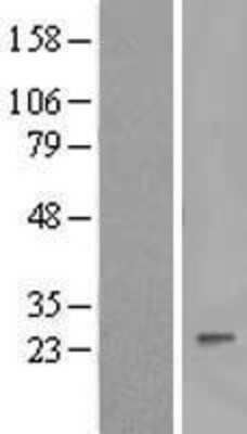 Western Blot: IFN-alpha B2/IFN-alpha 8 Overexpression Lysate [NBL1-11846]