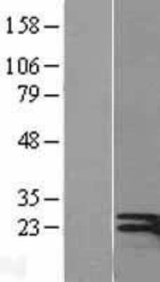 Western Blot: IFN-gamma Overexpression Lysate [NBL1-11851]