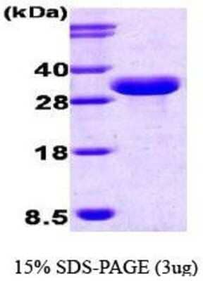 SDS-PAGE: Recombinant Human ISG15/UCRP Calmodulin Protein [NBC1-18442]