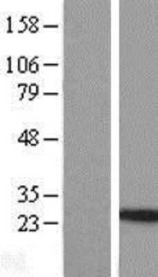 Western Blot: IL-24 Overexpression Lysate [NBL1-11945]