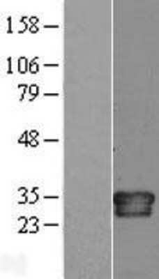 Western Blot: IL-34 Overexpression Lysate [NBL1-11955]