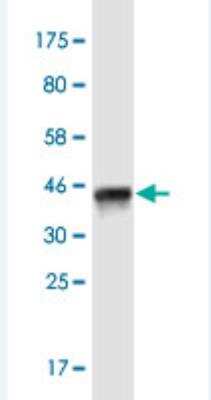 Western Blot: Intersectin 1 Antibody (2F12) [H00006453-M02-100ug]