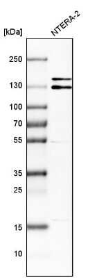 Western Blot: Intersectin 1 Antibody [NBP1-87806]