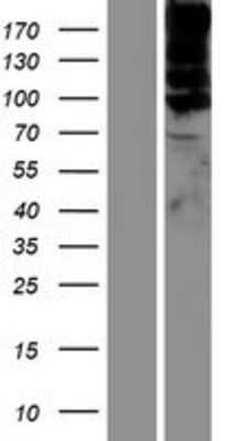 Western Blot: Intersectin 1 Overexpression Lysate [NBP2-10857]