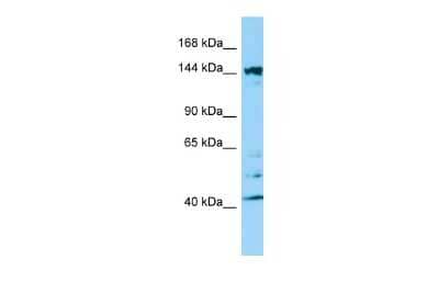 Western Blot: Intersectin 2 Antibody [NBP2-86680]