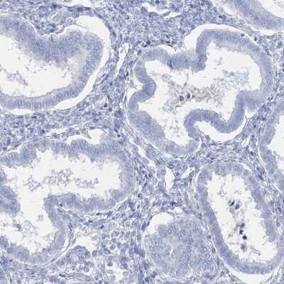 Immunohistochemistry-Paraffin: Intra Acrosomal Protein Antibody [NBP1-88038]