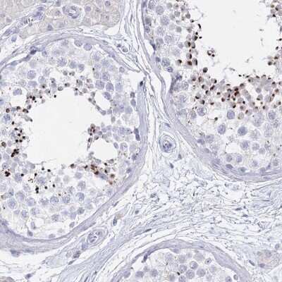 Immunohistochemistry-Paraffin: Intra Acrosomal Protein Antibody [NBP1-88038]