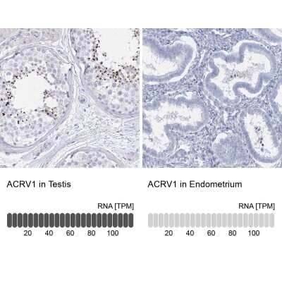 Immunohistochemistry-Paraffin: Intra Acrosomal Protein Antibody [NBP1-88038]